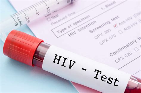 hiv blood test results.